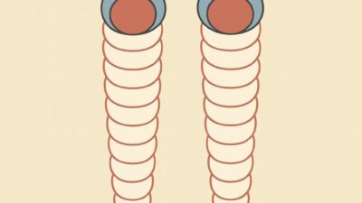 脾臓の血積(ひぞうのけっしゃく)